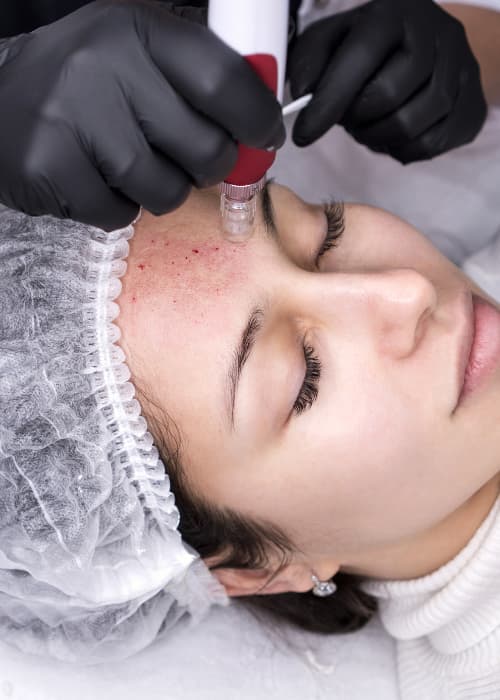 Woman Getting head treatment with a machine